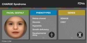 CHARGE Syndrome