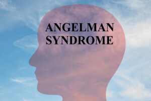 signs of angelman syndrome