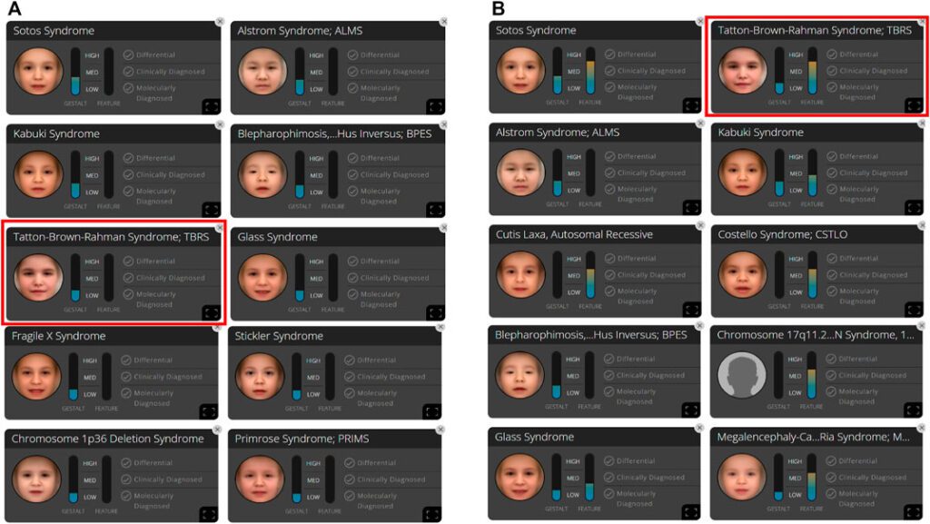 Rare Genetic Syndromes